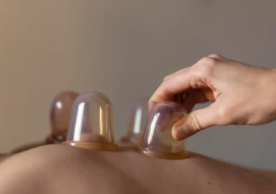 CUPPING THERAPY