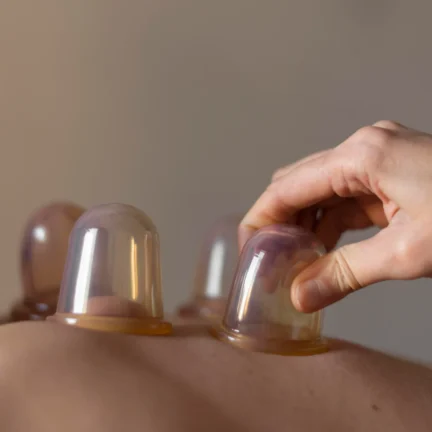 CUPPING THERAPY
